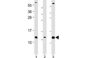 Western Blotting (WB) image for anti-Cyclin-dependent kinases regulatory subunit 2 (CKS2) (AA 6-40), (Regulatory Subunit 2) antibody (ABIN5708071)
