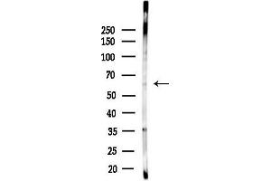 Western blot analysis of lysates from HepG2 cells(heat-shock,45 min treatment), using LILR Antibody at 1/1000 dilution.
