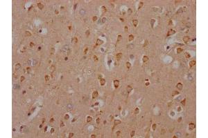 IHC image of ABIN7127314 diluted at 1:100 and staining in paraffin-embedded human brain tissue performed on a Leica BondTM system. (Recombinant HTR2C 抗体)