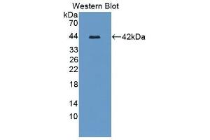 Western Blotting (WB) image for anti-serpin Peptidase Inhibitor, Clade D (Heparin Cofactor), Member 1 (SERPIND1) (AA 256-342) antibody (ABIN1868333) (SERPIND1 抗体  (AA 256-342))
