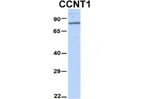 Host:  Rabbit  Target Name:  CCNT1  Sample Type:  Hela  Antibody Dilution:  1. (Cyclin T1 抗体  (N-Term))