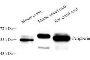 Western blot analysis of peripherin (ABIN7075012) at dilution of 1: 1000 (Peripherin 抗体)