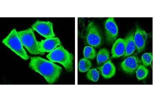 Confocal immunofluorescence analysis of methanol-fixed HepG2 (left) and Hela (right) cells using GAPDH antibody (green), showing cytoplasmic localization. (GAPDH 抗体)
