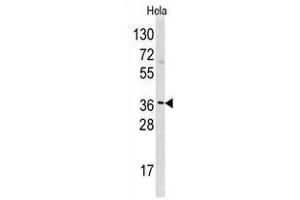 Image no. 1 for anti-Histamine N-Methyltransferase (HNMT) (N-Term) antibody (ABIN356933) (HNMT 抗体  (N-Term))