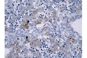 RGS9 antibody was used for immunohistochemistry at a concentration of 4-8 ug/ml to stain Hepatocytes (arrows) in Human Liver. (RGS 抗体  (N-Term))