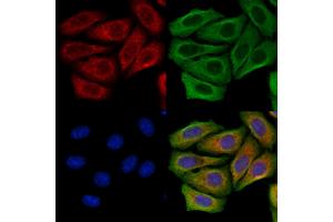 FUT6 Antibody staining Hela cells by IF/ICC. (FUT6 抗体  (N-Term))