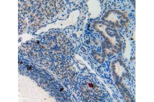 Used in DAB staining on fromalin fixed paraffin- embedded ovary tissue (PPL 抗体  (AA 1501-1754))