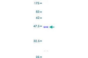 LSM1 Protein (AA 1-133) (GST tag)