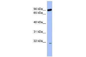 WB Suggested Anti-RNF135 Antibody Titration:  0. (RNF135 抗体  (Middle Region))
