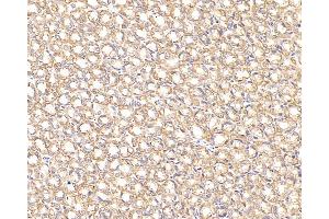 Immunohistochemistry analysis of paraffin-embedded Rat stomach cancer using CK-7 Monoclonal Antibody at dilution of 1:300. (Cytokeratin 7 抗体)