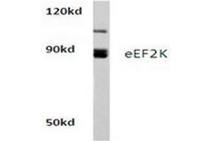 Image no. 1 for anti-Eukaryotic Elongation Factor-2 Kinase (EEF2K) antibody (ABIN265393)