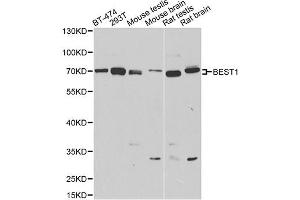 Western blot analysis of extracts of various cell lines, using BEST1 antibody (ABIN4903043) at 1:1000 dilution. (Bestrophin 1 抗体)