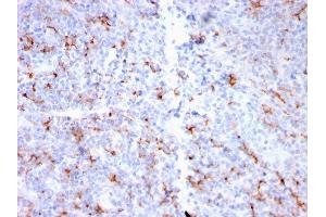Formalin-fixed, paraffin-embedded human Tonsil stained with S100A8/A9 Complex Recombinant Rabbit Monoclonal Antibody (MAC3157R). (Recombinant S100A8 抗体)