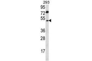ABHD2 Antibody (Center) western blot analysis in 293 cell line lysates (35 µg/lane). (ABHD2 抗体  (Middle Region))
