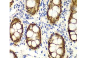 Immunohistochemistry of paraffin-embedded Human colon using GIPC2 Polyclonal Antibody at dilution of 1:100 (40x lens). (GIPC2 抗体)