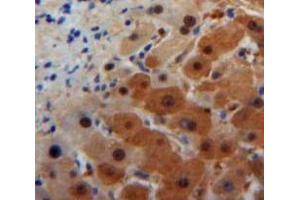 Used in DAB staining on fromalin fixed paraffin-embedded Liver tissue (ORM1 抗体  (AA 19-207))
