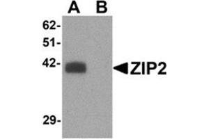 Western blot analysis of ZIP2 in rat brain tissue lysate with ZIP2 antibody at 1 μg/ml in (A) the absence and (B) the presence of blocking peptide. (ZIP2 抗体  (N-Term))