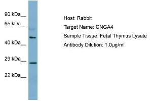 Host: Rabbit Target Name: CNGA4 Sample Type: Fetal Thymus lysates Antibody Dilution: 1. (CNGA4 抗体  (N-Term))