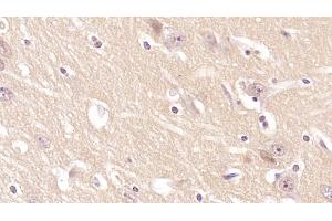 Detection of CD97 in Human Cerebrum Tissue using Monoclonal Antibody to Cluster Of Differentiation 97 (CD97) (CD97 抗体  (AA 58-260))
