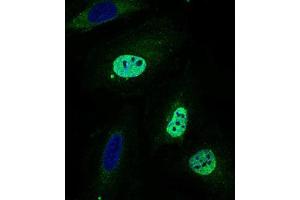 Immunofluorescence (IF) image for anti-Wolf-Hirschhorn Syndrome Candidate 2 (WHSC2) (AA 280-511) antibody (ABIN1724801)