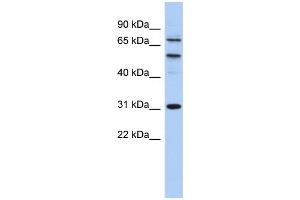 WB Suggested Anti-SSRP1 Antibody Titration: 0. (SSRP1 抗体  (Middle Region))