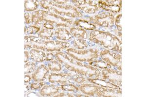 Immunohistochemistry of paraffin-embedded mouse kidney using NDUFB9 Rabbit mAb (ABIN7268815) at dilution of 1:200 (40x lens). (NDUFB9 抗体)