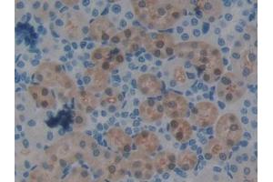 Immunohistochemistry (IHC) image for anti-Glutathione S-Transferase alpha 1 (GSTA1) (AA 2-222) antibody (ABIN1078074)