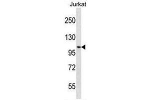 CENPC1 Antibody (Center) western blot analysis in Jurkat cell line lysates (35µg/lane). (CENPC1 抗体  (Middle Region))