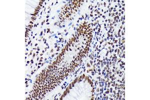 Immunohistochemistry of paraffin-embedded human appendix using EWSR1 Rabbit mAb (ABIN7267053) at dilution of 1:100 (40x lens). (EWSR1 抗体)