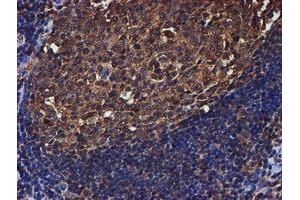 Image no. 3 for anti-Proteasome (Prosome, Macropain) Subunit, beta Type, 9 (Large Multifunctional Peptidase 2) (PSMB9) (AA 21-219) antibody (ABIN1491194)