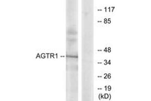 Western blot analysis of extracts from K562 cells, using AGTR1 Antibody. (Angiotensin II Type-1 Receptor 抗体  (AA 101-150))