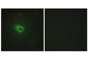 Immunofluorescence (IF) image for anti-Janus Kinase 1 (JAK1) (N-Term) antibody (ABIN1849257) (JAK1 抗体  (N-Term))