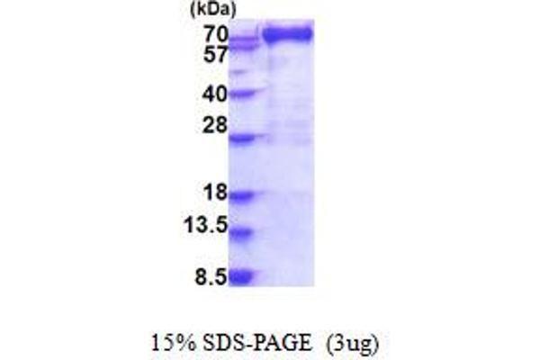 MX1 Protein (AA 1-662) (His tag)