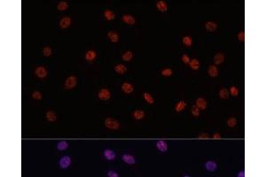 Immunofluorescence analysis of C6 cells using MYCT1 Polyclonal Antibody at dilution of 1:100. (Myc Target 1 抗体)