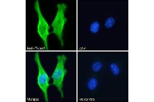 ABIN570923 Immunofluorescence analysis of paraformaldehyde fixed 3T3-L1 cells, permeabilized with 0. (TREM2 抗体  (Internal Region))
