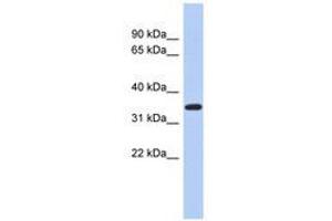 Image no. 1 for anti-Kruppel-Like Factor 6 (KLF6) (AA 71-120) antibody (ABIN6740430) (KLF6 抗体  (AA 71-120))