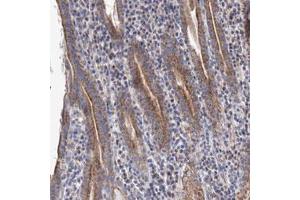 Immunohistochemical staining (Formalin-fixed paraffin-embedded sections) of human stomach with YARS2 polyclonal antibody  shows cytoplasmic positivity in glandular cells. (YARS2 抗体)