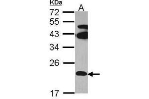 WB Image Sample (30 ug of whole cell lysate) A: Hela 12% SDS PAGE FAM18B antibody antibody diluted at 1:1000 (TVP23C/FAM18B2 抗体  (Internal Region))