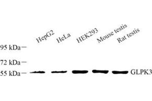 Western blot analysis of GLPK3 (ABIN7074046) at dilution of 1: 1000 (GLPK3 抗体)