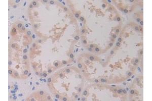 Immunohistochemistry (IHC) image for anti-Breast Cancer 1 (BRCA1) (AA 19-83) antibody (ABIN7433579)