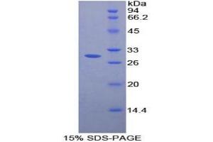 SDS-PAGE analysis of Rat FcgRII Protein. (Fc gamma RII (CD32) 蛋白)