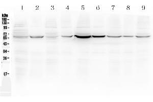 Western blot analysis of ESR2 using anti-ESR2 antibody . (ESR2 抗体  (AA 289-501))
