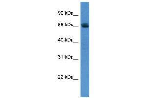 Western Blotting (WB) image for anti-SWI/SNF Related, Matrix Associated, Actin Dependent Regulator of Chromatin, Subfamily D, Member 3 (SMARCD3) (N-Term) antibody (ABIN2776387)