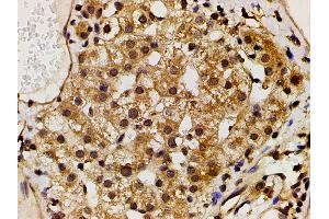 Immunohistochemistry (IHC) image for anti-Phosphoinositide 3 Kinase, p85 alpha (PI3K p85a) (pTyr607) antibody (ABIN6256775)