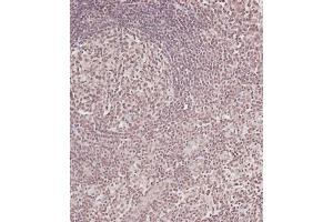 Immunohistochemical analysis of (ABIN6243102 and ABIN6578913) on paraffin-embedded Human tonsil tissue. (CDC25A 抗体  (Ser124))