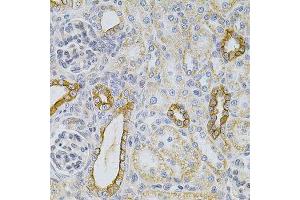 Immunohistochemistry of paraffin-embedded rat kidney using KRT20 Antibody.