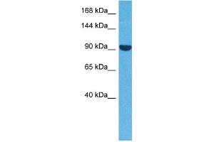 Host:  Rabbit  Target Name:  ACTN3  Sample Tissue:  Human A549 Whole Cell  Antibody Dilution:  1ug/ml