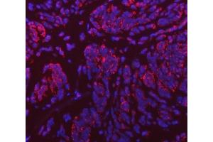 IF analysis of VPS53 using anti-VPS53 antibody (ABIN7599731).
