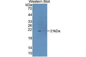 Western blot analysis of the recombinant protein. (Complexin 1 抗体  (AA 1-134))