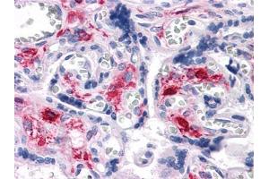 Immunohistochemical analysis of paraffin-embedded human Liver tissues using NKX3A antibody (NKX3-1 抗体)